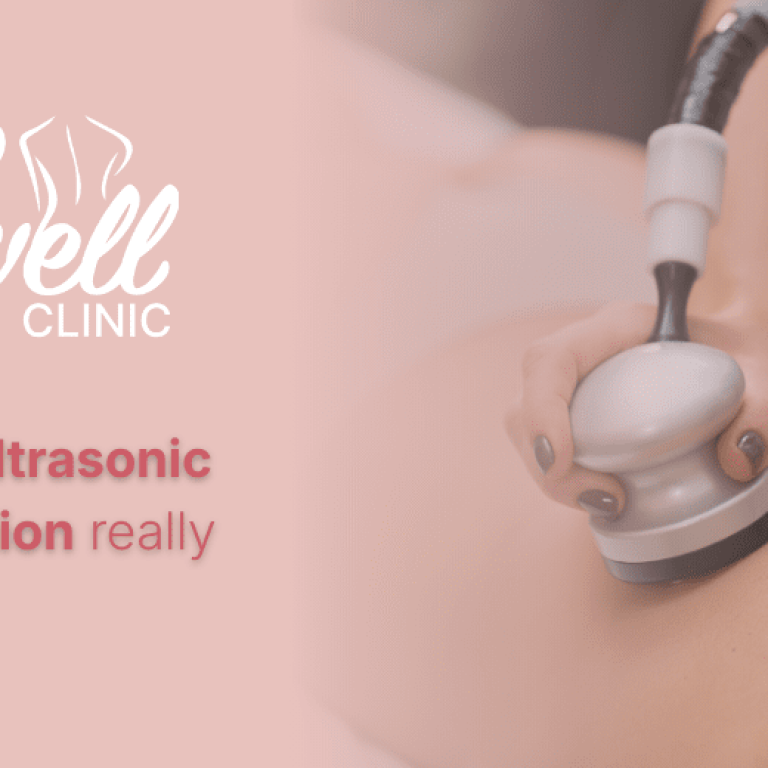 cavitation